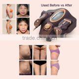 Portable Multi Function Slimming Portable Home Use Cellulite Reduction Body Slimming Device thumbnail-4