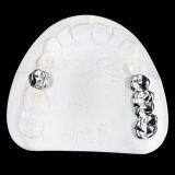 Full Metal Crown, FMC, FGC, Full Metal Post Core, Dental Crown, Cast Metal Crown, Dental Prosthesis, Laboratorio Dental, Dental Laboratory, Dentallabor, LJ Dental Lab China thumbnail-4