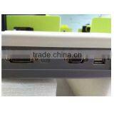 Hot Sale!!! Three Channel ECG Machine With Best Price MSLEC04-4 thumbnail-6