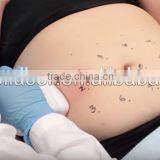 8MHz 2016 Body Shape Fastest Weight Loss Chest Shaping Slimming Liposonix HIFU Portable Ultrashape Cavitation Machine High Frequency Beauty Machine thumbnail-3