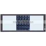 Medical Laboratory Equipment x Ray Film Viewer thumbnail-1