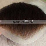 Stock Hair Replacement Systems thumbnail-1