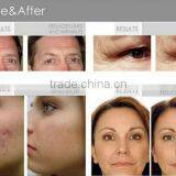 Ultrasonic Beauty Machine With High Frequency Vacuum Spray OL-3001A Beauty Massage thumbnail-5