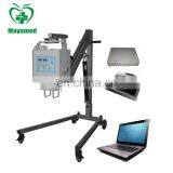 MY-D019A High Frequency Medical X-ray Generator or Fluoroscopy Machine of Digital Portable x Ray for Sale thumbnail-6
