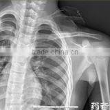 Good Sale Konida Medical Photosensitive Dry Laser X-ray Film thumbnail-1