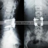 China KND-A/F CE medical dry film agfa de mexico