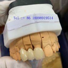 Safety Corrosion Resistant OEM Porcelain Crown All Ceramic Natural Look thumbnail-2