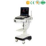 MY-A039A Color Doppler Ultrasound Price Portable Ultrasound Machine thumbnail-5