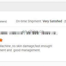 Picosecond Tattoo Removal Laser Beauty Equipment Popular q Switched nd Yag Laser Machine for Sale thumbnail-4