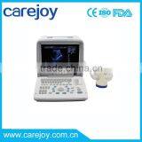 Promotion!CE Approved Portable B-Mode Ultrasound Scanner With 3.5Mhz Multi-frequency Convex Probe RUS-9000B thumbnail-1