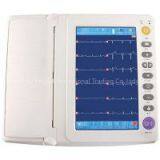 ECG  Electrocardiography