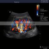 New Type Laptop Color Doppler Ultrasound for Human With Laptop thumbnail-6