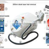 Weifang Sunshine Electronics Hair Removal Products for Women Use Vigina Hair Removal thumbnail-5