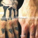 1500mj Best Effective Laser Tattoo Removal Machine Q 800mj Switch Nd Yag Laser With Spot Size Adjustable thumbnail-6