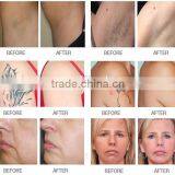 Sales Discount Diode Ipl Hair Removal Facial Whitening Multifunctional Machine thumbnail-5
