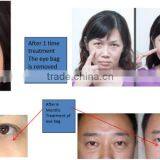 Eye Beauty Device for Removing Eye Wrinkle ,eye Bag thumbnail-6