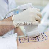 2000 Shots 2016 Cellulite Reduction Liposonix HIFU Slimming Machine Hips Shaping thumbnail-5