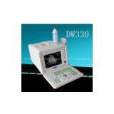 Full-digital Portable Ultrasound Scanner China