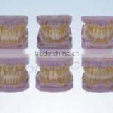 Orthodontic Classification Model ( Two-color , a Set of 10 Groups )/dental Orthodontic Modelsmodels thumbnail-1