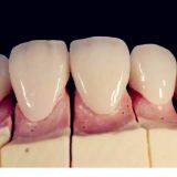 Factory Direct Dental Lab Supply Quality Zirconia Sintering Dental Lab Equipment thumbnail-5