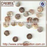 Wholesale 100% Natural Matertial Agoya Shell Troca Shell River Shell Real Shell Button for Garment thumbnail-1