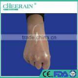 Waterproof Adhesive Transparent Semi-permeable DRESSING thumbnail-3