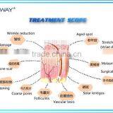 Medical Surgery Cutting Fractional Co2 Laser Vaginal America Emitter thumbnail-2
