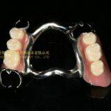 Dental Co-Cr Partial Denture,Titanium Framework Denture, Dental Dentures, Laboratoire Dentaire, Dentallabor, Laboratorio Dental, Dental Laboratory, Shenzhen LJ Dental Lab China thumbnail-3