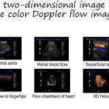 China Trolley 4D Color Doppler Ultrasound (YJ-U10T) thumbnail-5