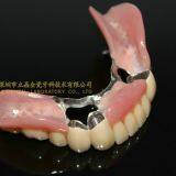 Dental Telescope Denture, Telesope Crown, Dental Prosthesis, Laboratoire Dentaire, Dentallabor, Laboratorio Dental, Dental Laboratory, Shenzhen LJ Dental Lab China thumbnail-5