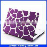 Top Level Cheapest Hard Cover Case for Macbook Air 11 thumbnail-2