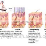Air Cooling Fractional Co2 Laser Machine 8.0 Inch For Wrinkle Spot Scar Pigment Removal Medical thumbnail-6