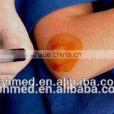 High Quality Injection Prp Kit thumbnail-4