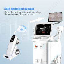 Aesthetic Medicine 4 Wavelengths 808nm Diode Hair Removal Laser Machine thumbnail-5