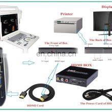 Hot Selling Medical Cheapest-portable-ultrasound-machine for Hospital and Clinic Use thumbnail-3