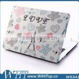 New Products Frosted Printing Matte Case for Macbook Air Pro Retian 11'' 13'' 15'' thumbnail-1