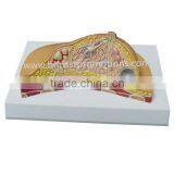 Teaching Breast Model, Mastitis Anatomical Model thumbnail-1