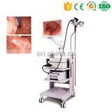 MY-P006B Medical HD Endoscope System With Video Gastroscope and Video Colonoscope thumbnail-3