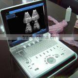 Sonostar Hospital Veterinary Equipment B Model Ultrasound Machine for Sale V9 thumbnail-3