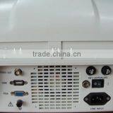 CE Approved Portable B-Mode Ultrasound Scanner With 3.5Mhz Multi-frequency Convex Probe RUS-6000A thumbnail-4