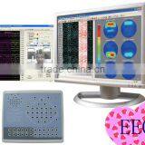 2016 NEW 24 Hours Continuous Recording 24 or 32 Channel Digital EEG Mapping Machine Supplier thumbnail-1