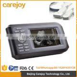 2016 New Handheld Ultrasound Scanner Palm Ultrasound Machine thumbnail-1