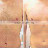 Permanent 808nm Diode Laser Bode Hair Removal With No Pain Arm / Chest Hair Removal thumbnail-4