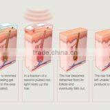 Professional IPL Vein Removal Laser Spring Facial Hair Removal Machine thumbnail-6