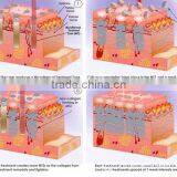 Portable 40W RF Tube Pixel Co2 Fractional Laser With Virginal Tightening thumbnail-4