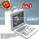 Coupon available! MSLPU01 cheapest portable ultrasound machine on Alibaba