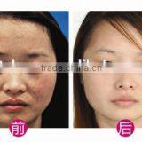 1 HZ Q Switch Nd Yag Laser Tattoo Q Switch Laser Machine Removal Skin Rejuvenation Machine Tattoo Laser Removal Machine thumbnail-3