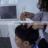 Top Sale 650nm Diode Laser Best Hair Regrowth Machine thumbnail-4