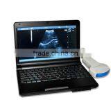 Carejoy CE Laptop 10.1 Inch Ultrasound Scanner / Machine With 3.5Mhz Convex Probe Good Price thumbnail-4