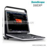 Pregnancy Portable Vascular Color Doppler Ultrasound System